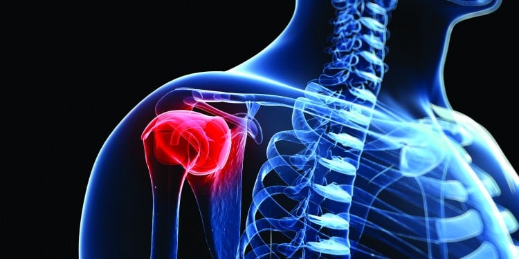 Предотвращение травм вращательной манжеты плеча с помощью корректирующих упражнений (часть 1)